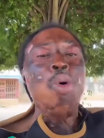 Deteriorating facial skin of Nana Kweku Bonsam